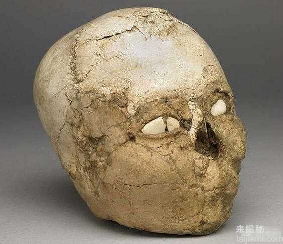 9500年前畸形头骨 复原考古学家看呆了839 / 作者:UFO来啦 / 帖子ID:61285