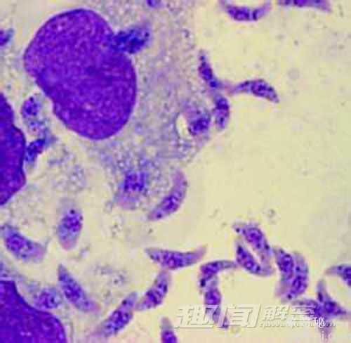 揭秘：弓形虫会影响人对猫的喜爱程度739 / 作者:UFO来啦 / 帖子ID:64040