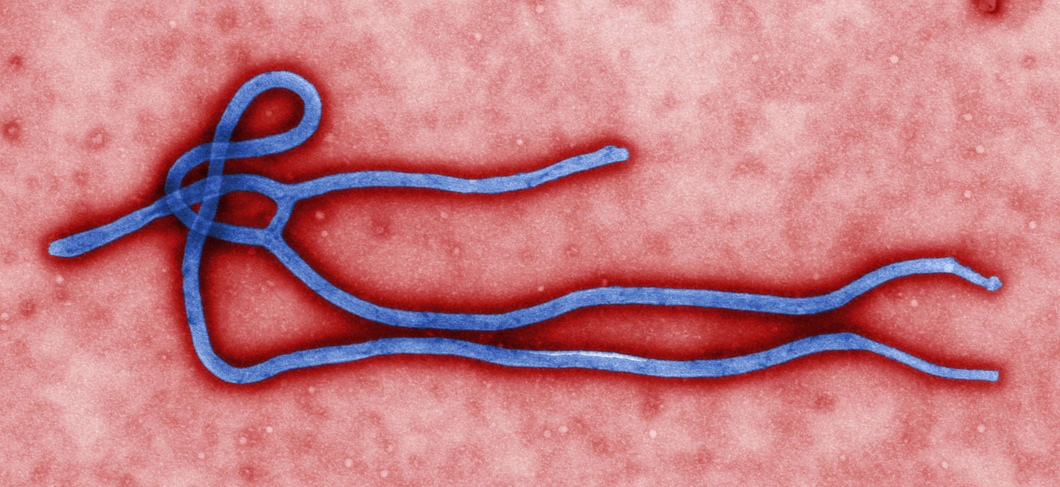 感染埃博拉（Ebola）病毒会怎么样？998 / 作者:ihHXMlfZ / 帖子ID:56052