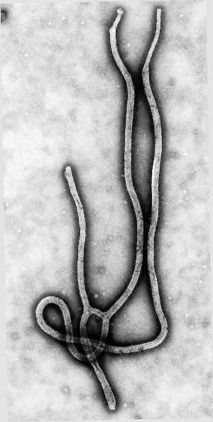 感染埃博拉（Ebola）病毒会怎么样？311 / 作者:迟到399 / 帖子ID:56052