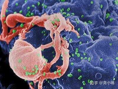 感染埃博拉（Ebola）病毒会怎么样？766 / 作者:akmpswv / 帖子ID:56052