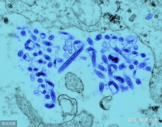 感染埃博拉（Ebola）病毒会怎么样？690 / 作者:akmpswv / 帖子ID:56052