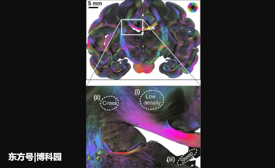 终于实现：绘制大脑神经纤维路径交叉点，创建大脑真3D不难了！311 / 作者:xinting_6ym / 帖子ID:58700