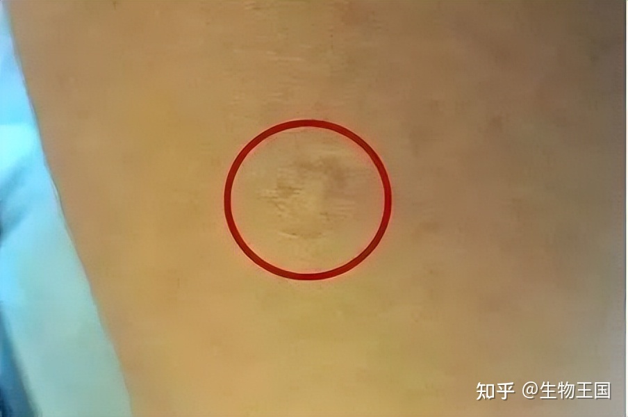 地球上的生物都有天敌相克，怎么从没听说病毒的天敌？病毒 ...712 / 作者:宋长宁 / 帖子ID:97233