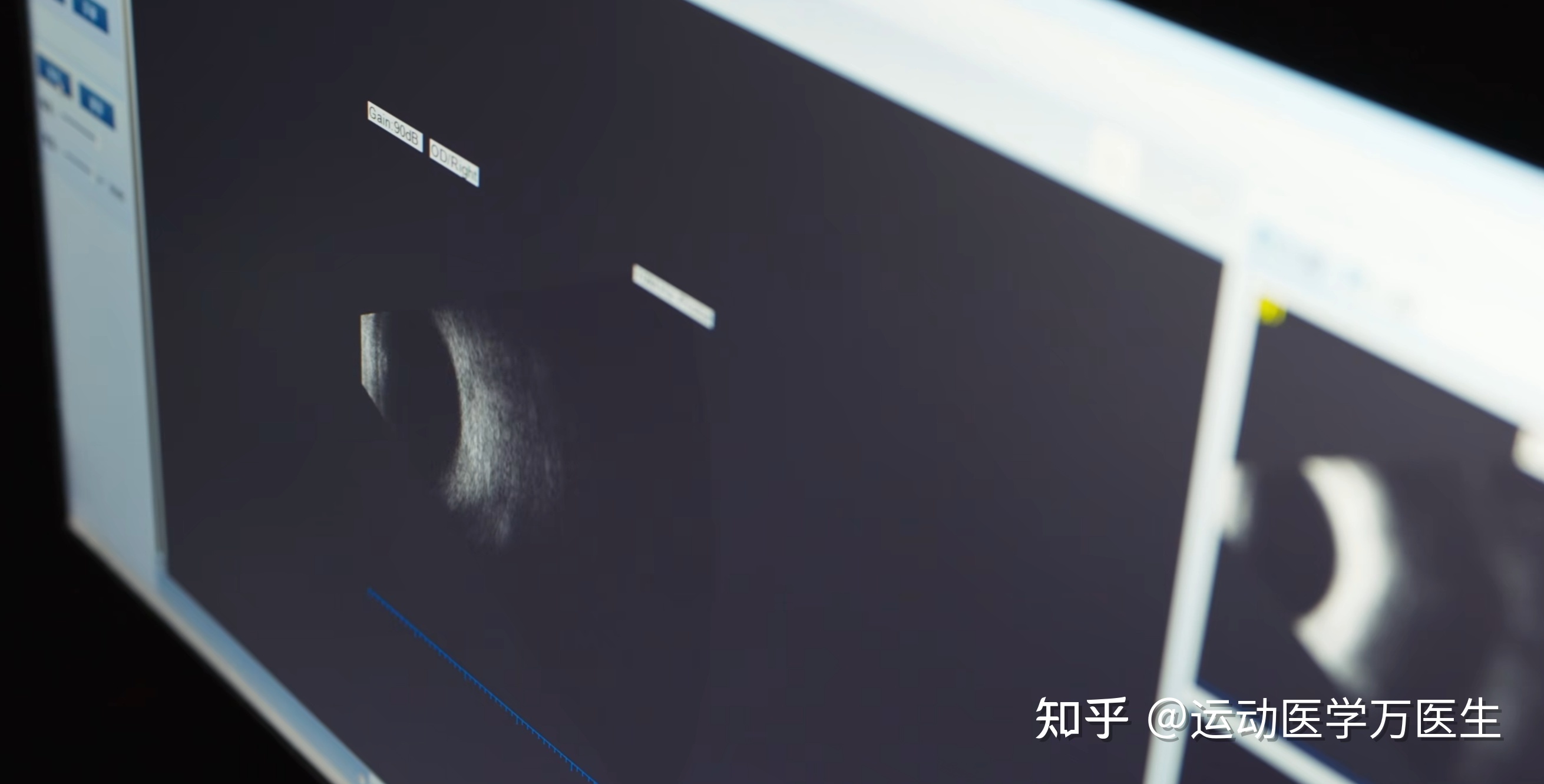 电视剧《三体》登上央视，腾讯视频开播 1 小时便创纪录 ...260 / 作者:雷JY / 帖子ID:105951