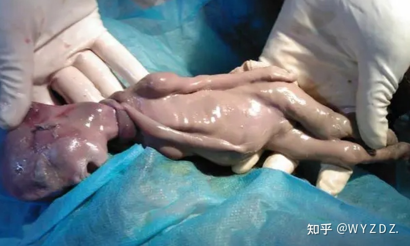 关于堕胎的灵异事件{绝对真实}431 / 作者:維健_廣律 / 帖子ID:108439
