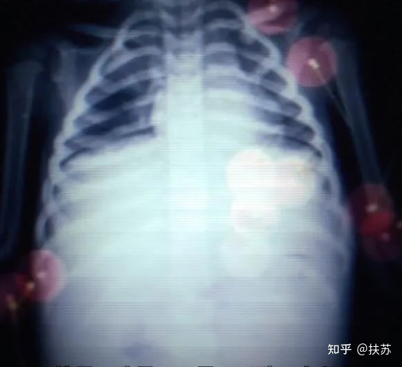 有哪些真实发生的著名连环或变态杀人案？344 / 作者:想不到918 / 帖子ID:109349