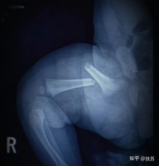 有哪些真实发生的著名连环或变态杀人案？578 / 作者:想不到918 / 帖子ID:109349