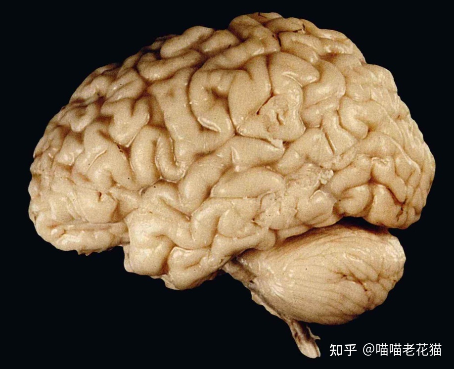 生物心理学笔记210 / 作者:魔幻双琪座双q / 帖子ID:111247