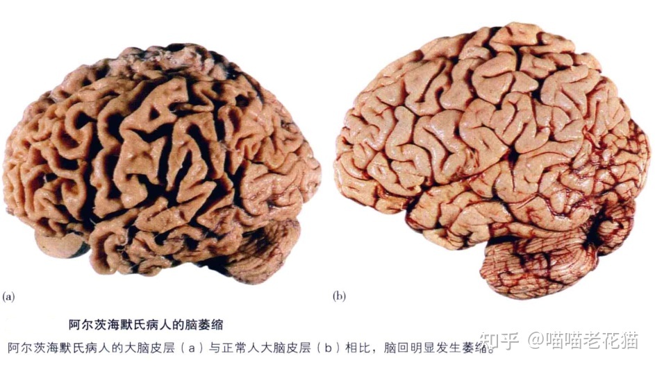 生物心理学笔记640 / 作者:魔幻双琪座双q / 帖子ID:111247
