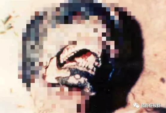 都市传说？：1988年巴西男性超神秘死亡 …34 / 作者:湿湿二 / 帖子ID:111722