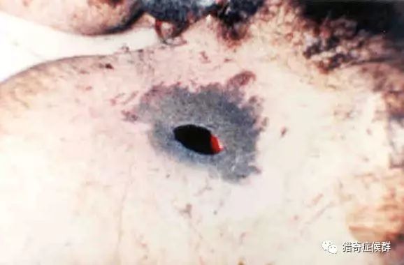 都市传说？：1988年巴西男性超神秘死亡 …919 / 作者:湿湿二 / 帖子ID:111722