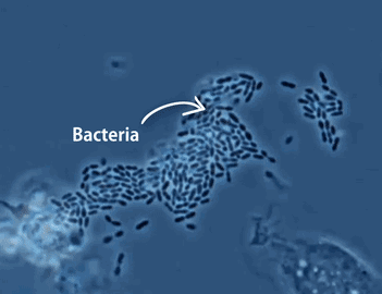 动图演示：为了你的健康，免疫系统在拼命！生物知识也可以很简单99 / 作者:liuyp1 / 帖子ID:123972