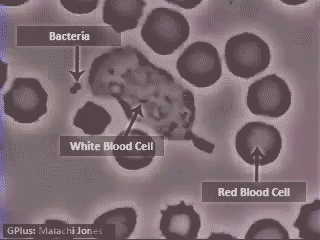 动图演示：为了你的健康，免疫系统在拼命！生物知识也可以很简单555 / 作者:liuyp1 / 帖子ID:123972