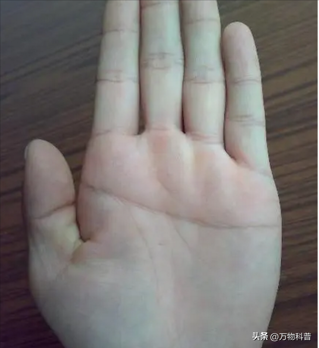 世界上最稀有12种人体特征，看看你占了几个，你会是天选之子吗？255 / 作者:焦饭转锅巴速 / 帖子ID:126428