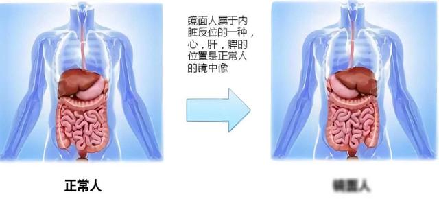 世界上最稀有7种人体特征，看看你占了几个，你会是天选之子吗？927 / 作者:penguinzhuyun / 帖子ID:126454