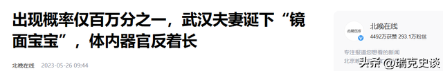 世界上最“稀有”6种人体特征，看看你占了几个，你是天选之子吗893 / 作者:艾克n / 帖子ID:126577