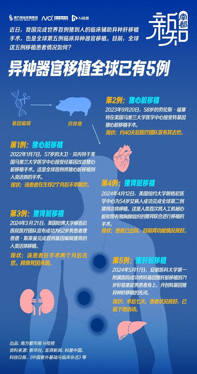 动物器官“安”在人身上，世界上最早手术的5人咋样了925 / 作者:fengzhrng / 帖子ID:127404