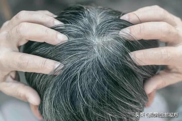 世界上最“稀有”6种人体特征，看看你占了几个，你是天选之子吗359 / 作者:冷艳林壳 / 帖子ID:127743