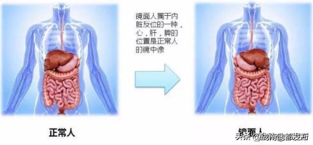 世界上最“稀有”6种人体特征，看看你占了几个，你是天选之子吗928 / 作者:冷艳林壳 / 帖子ID:127743