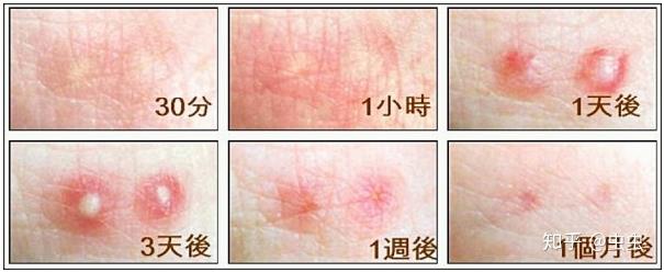 红火蚁的真实样子图片 红火蚁咬人后症状图片821 / 作者:UFO爱好者 / 帖子ID:78211