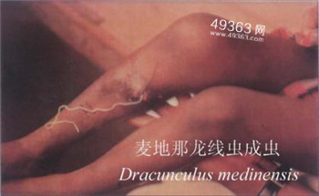 恐怖的寄生虫：控制人体大脑思想 专吃鱼舌头452 / 作者:UFO爱好者 / 帖子ID:87758