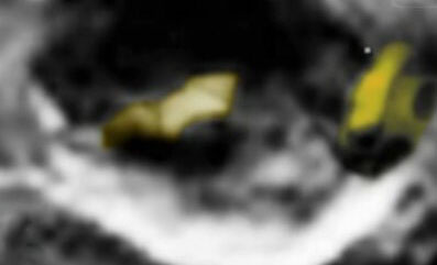谷神星上发现神秘金属 或与外星人有关527 / 作者:UFO爱好者 / 帖子ID:75605