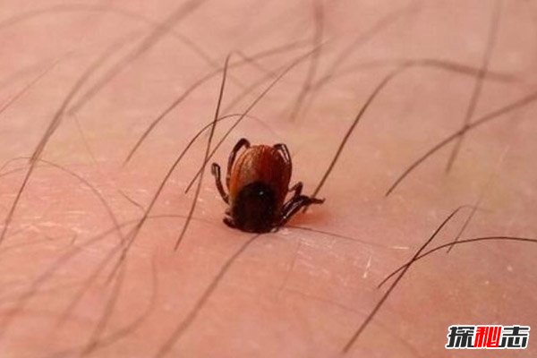 世界十大吸血鬼生物，吸血鲶鱼通过尿道钻入人体（恐怖至极）400 / 作者:UFO爱好者 / 帖子ID:105816