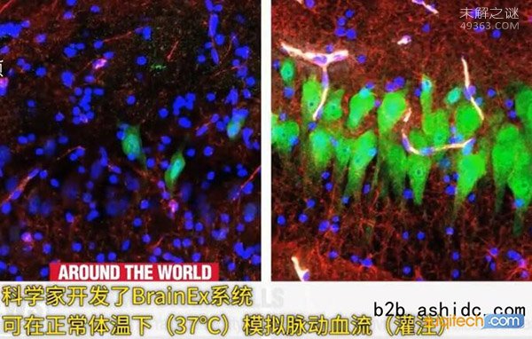 美国科学家成功复活了猪的大脑，死亡的大脑有复活的可能860 / 作者:UFO爱好者 / 帖子ID:70506