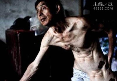 云南死亡之村之谜，猝死迷雾依旧疑点重重944 / 作者:UFO爱好者 / 帖子ID:73305