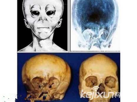墨西哥罕见现外星人和地球人混血儿头骨(图)441 / 作者:UFO爱好者 / 帖子ID:84415 墨西哥罕见现外星人和地球人混血儿头骨(图)441 / 作者:UFO爱好者 / 帖子ID:84415