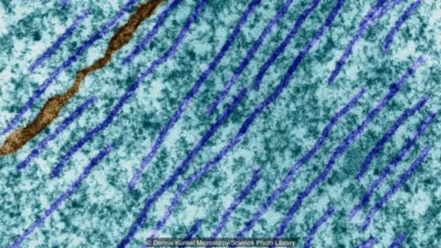 既然观测量子系统会影响结果，所以量子力学与意识相关吗？450 / 作者:UFO爱好者 / 帖子ID:86324