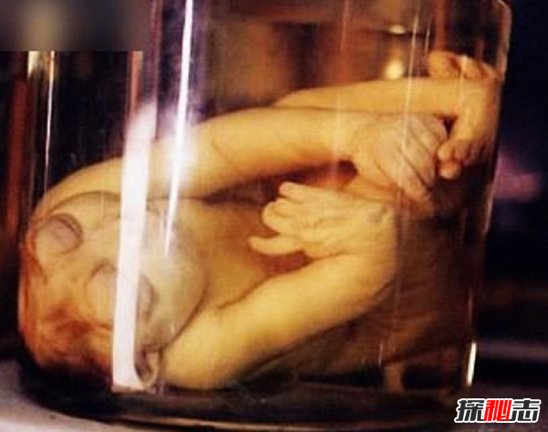 美国穆特博物馆肥皂女尸,重口味分分钟想吐(腐烂女尸成肥皂)561 / 作者:UFO爱好者 / 帖子ID:105426