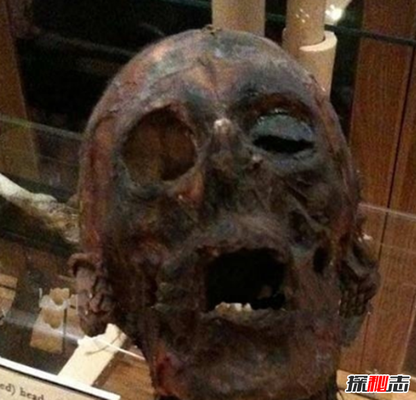 美国穆特博物馆肥皂女尸,重口味分分钟想吐(腐烂女尸成肥皂)867 / 作者:UFO爱好者 / 帖子ID:105426