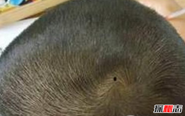 男人哪里长痣最有福气,男人10处有痣是富贵痣535 / 作者:UFO爱好者 / 帖子ID:80227
