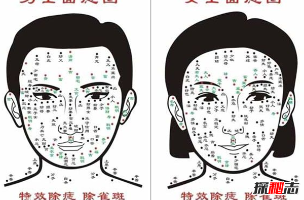 哪些痣必须点掉?必须取的十大凶痣(图解)877 / 作者:UFO爱好者 / 帖子ID:90192