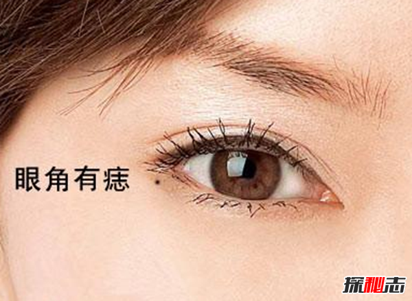 哪些痣必须点掉?必须取的十大凶痣(图解)195 / 作者:UFO爱好者 / 帖子ID:90192