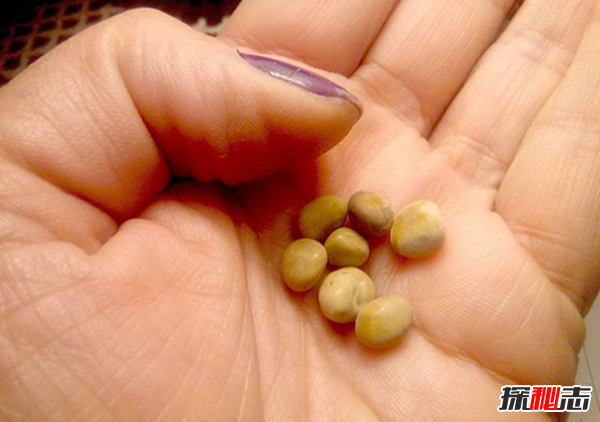 十个恐怖的真实医学故事,你能坚持看完吗?(令人不安)567 / 作者:UFO爱好者 / 帖子ID:104664