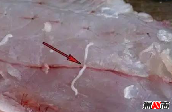 胸部寄生虫是什么?怎么辨别皮肤有寄生虫(严重会危及生命)831 / 作者:UFO爱好者 / 帖子ID:105075