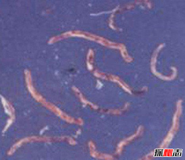 胸部寄生虫是什么?怎么辨别皮肤有寄生虫(严重会危及生命)48 / 作者:UFO爱好者 / 帖子ID:105075