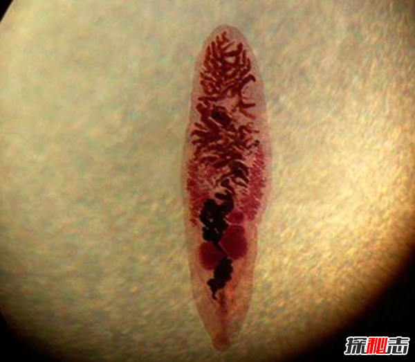 胸部寄生虫是什么?怎么辨别皮肤有寄生虫(严重会危及生命)818 / 作者:UFO爱好者 / 帖子ID:105075