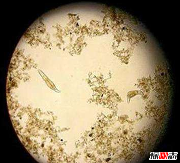 胸部寄生虫是什么?怎么辨别皮肤有寄生虫(严重会危及生命)338 / 作者:UFO爱好者 / 帖子ID:105075