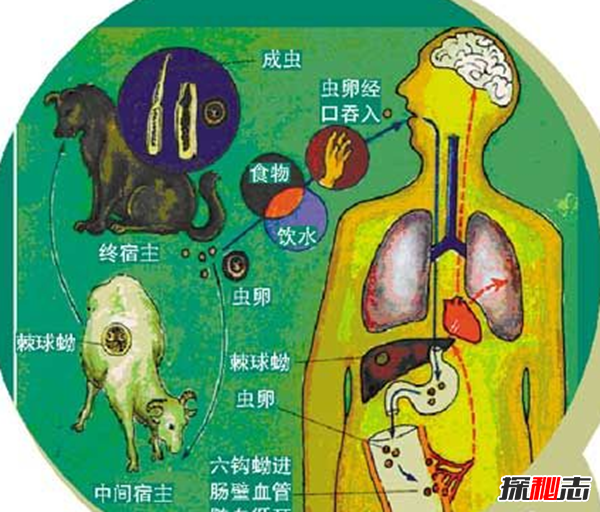 胸部寄生虫是什么?怎么辨别皮肤有寄生虫(严重会危及生命)621 / 作者:UFO爱好者 / 帖子ID:105075