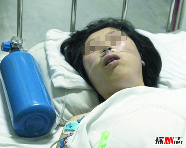 胸部寄生虫是什么?怎么辨别皮肤有寄生虫(严重会危及生命)292 / 作者:UFO爱好者 / 帖子ID:105075