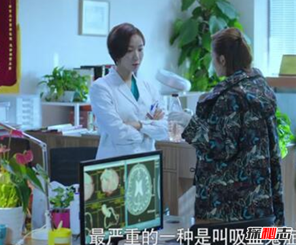 卟啉病为什么要喝血?卟啉病真实患者图片(吸血鬼的原型病)720 / 作者:UFO爱好者 / 帖子ID:105098