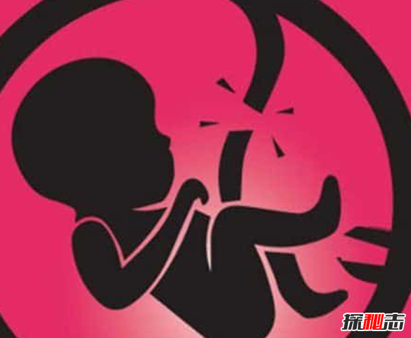 告诉你堕胎的真相,堕胎时胎儿是如何被杀死的?(惨不忍睹)736 / 作者:UFO爱好者 / 帖子ID:105013