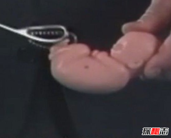 告诉你堕胎的真相,堕胎时胎儿是如何被杀死的?(惨不忍睹)210 / 作者:UFO爱好者 / 帖子ID:105013