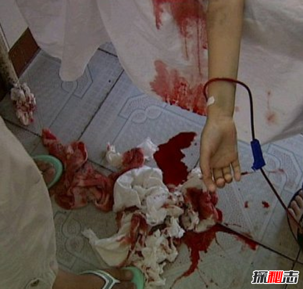 小苏丽事件是真的吗?小苏丽验尸照片(死后遭亲生母亲扒坟)750 / 作者:UFO爱好者 / 帖子ID:104947