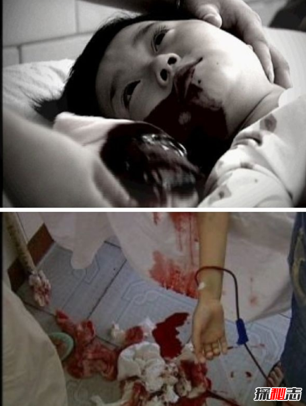 小苏丽事件是真的吗?小苏丽验尸照片(死后遭亲生母亲扒坟)338 / 作者:UFO爱好者 / 帖子ID:104947