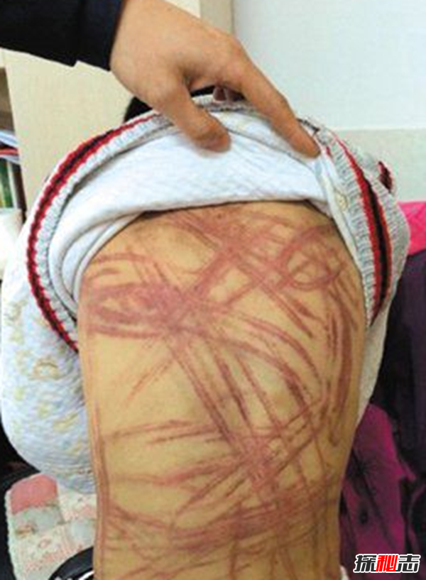 关于各地虐童事件新闻,虐童事件的认识与反思(莫以爱的名义伤害)695 / 作者:UFO爱好者 / 帖子ID:104946
